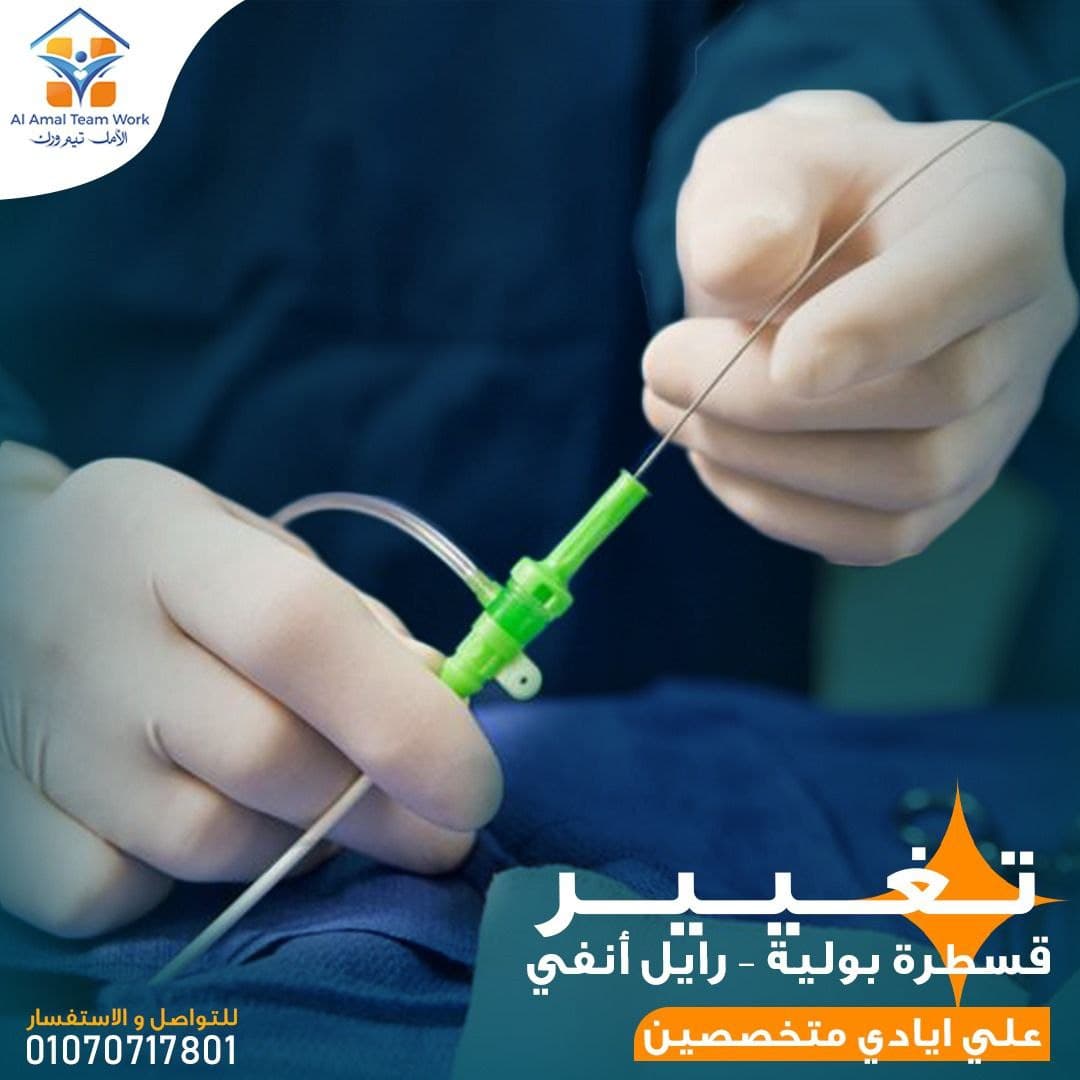 تغيير قسطرة بولية – رايل أنفي