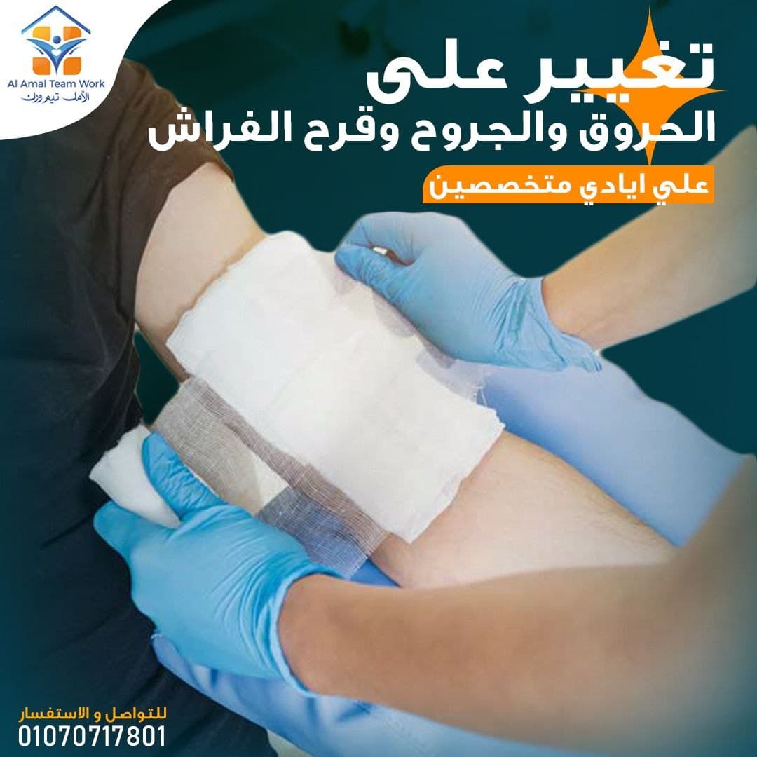 تغيير على الحروق والجروح وقرح الفراش